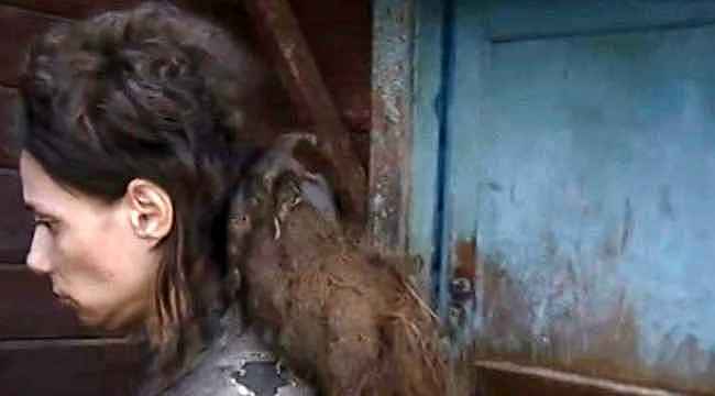 Böyle anne olur mu? Kızını 26 yıldır kedi mamasıyla beslemiş, 14 yıldır banyo yaptırmamış