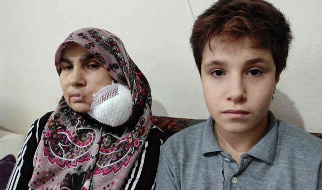Yüzündeki dev kitleden kurtulmak için yardım bekliyor