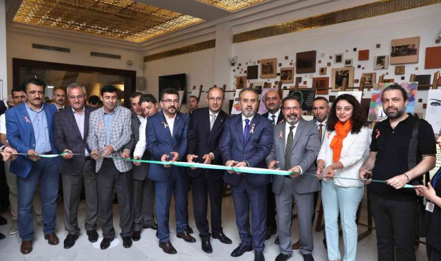 MS duyarlılığı sergisi