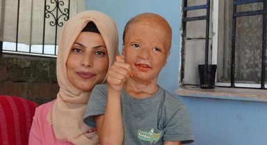 Yangında yaralanan 9 yaşındaki Halil, 3'üncü kez doku nakli için bekliyor
