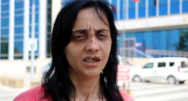 Tanımadığı Gamze'yi yumruklayan saldırgan için 6 yıla kadar hapis istemi