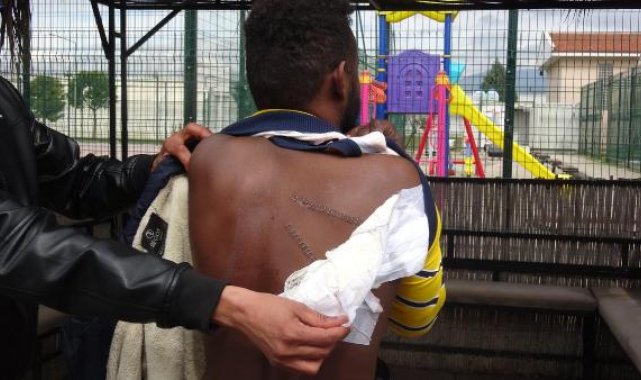 Yunan askerlerinin sırtından bıçakladığı Yemenli Abdullah'ın yaralarına 30 dikiş atıldı