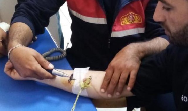 Balık tutarken koluna batan oltanın kancasını itfaiyeciler kesti