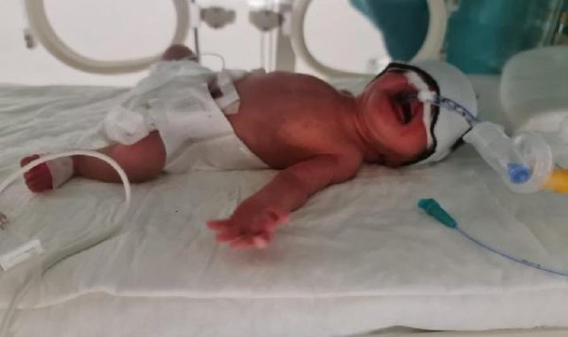 Karnından 5 kilo miyom çıkarıldı, ilk bebeğine kavuştu