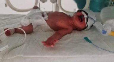 Karnından 5 kilo miyom çıkarıldı, ilk bebeğine kavuştu