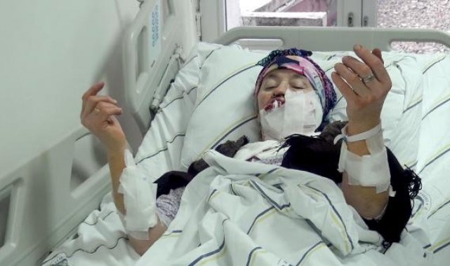 Köye inen kurt, 4 kişiyi yaraladı