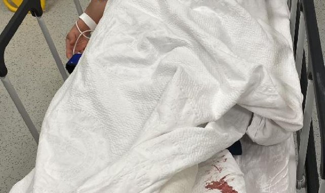 Hastaya müdahaleye giden Rabia, merdivenden itildi