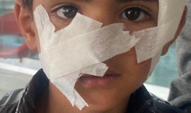 Köpeklerin saldırdığı çocuğa 40 dikiş atıldı