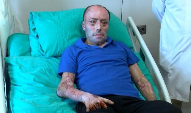 Bartın'da 43 kişinin öldüğü maden kazasında yaralanmıştı, 8 ay sonra taburcu edildi
