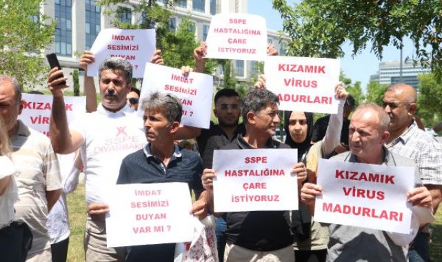 SSPE hastası çocukların aileleri Sağlık Bakan Yardımcısı Tolunay ile görüştü