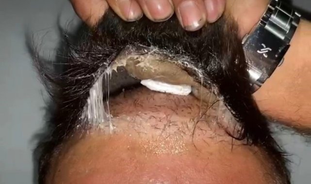 Şüphelinin peruğundan uyuşturucu çıktı