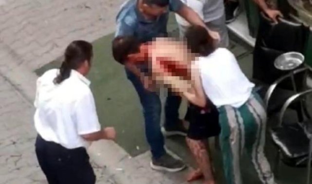 Apartman yöneticisi kavga ettiği anne ile oğlunu bıçakla yaraladı