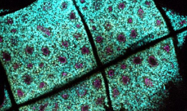 Dokudan minyatür organ üretimi ile Parkinson'a kalıcı çözüm arıyorlar