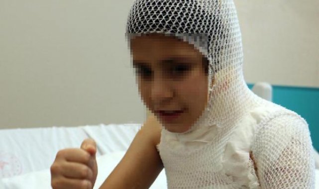 Fatma, sosyal medyadaki kolonya yakma videosu nedeniyle canından oluyordu