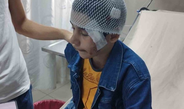 Salıncakta eğlenen çocuk bir anda kanlar içinde kaldı