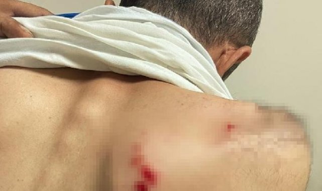 Kaçak elektrik kontrolü yapan ekibe saldıran 2 şüpheli gözaltına alındı