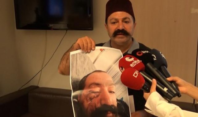 Sosyal medya fenomeninden kendisini darbeden ev sahibinin kardeşinin tahliyesine tepki