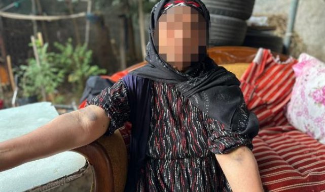 Babası şikayetini geri çekmeyince, 8 yaşındaki oğlunu tabancayla vurdular