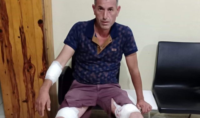 Sokak köpeklerinin saldırısına uğrayan Ersoy isyan etti