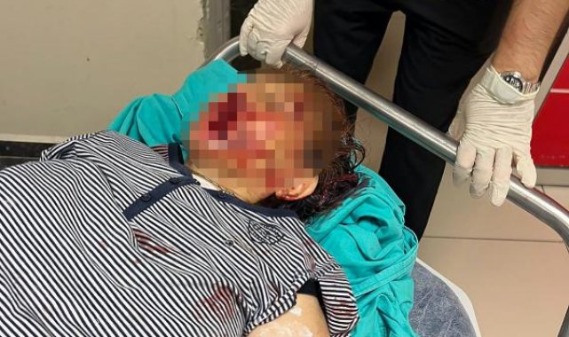 Tartıştıkları torunları demir kürek ile darbetti