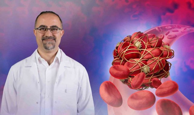 Tromboz hastalığı kanserin işareti olabilir
