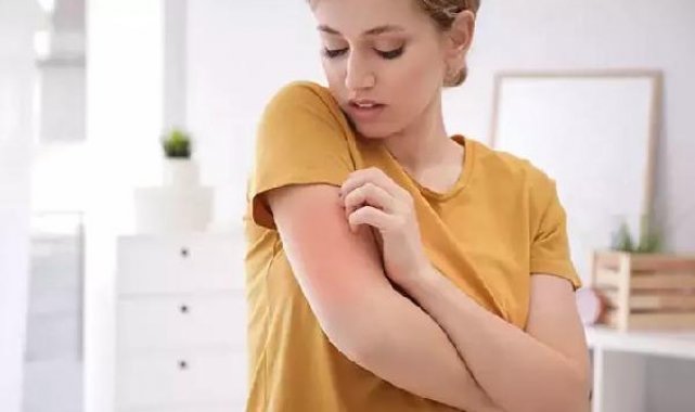 "Kliniklerdeki uyuz vakaları yüzde 25'e yükseldi"