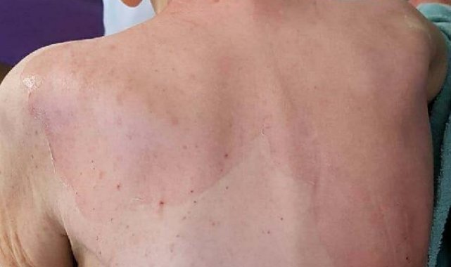Huzurevindeki banyo sonrası ölümde 2 görevliye hapis cezası