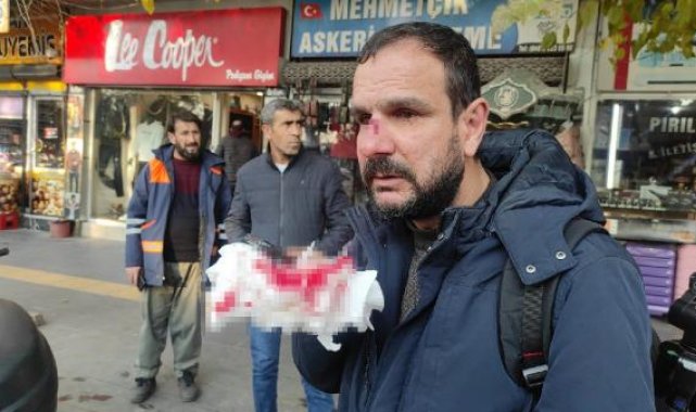 Minibüs sürücüsü, aracına motosikletiyle çarpan gazeteciyi darbetti