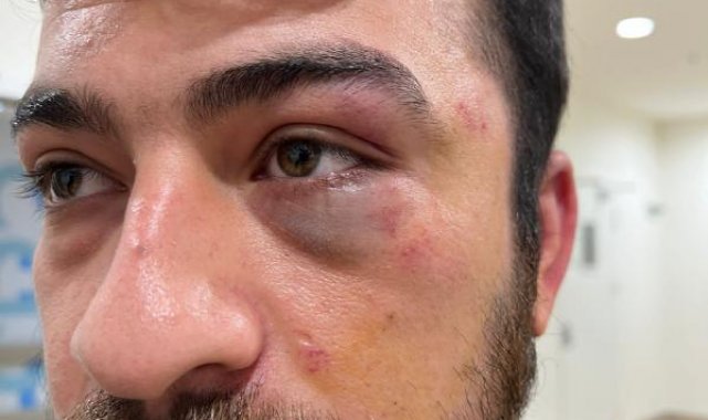 Şişli'de hemşireye saldırı; sağlık çalışanları eylem yaptı
