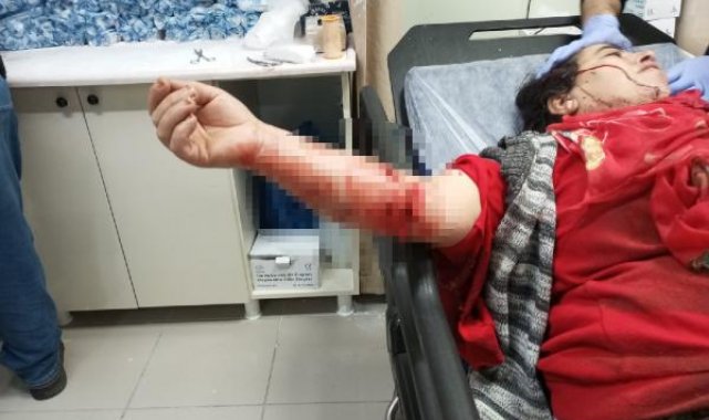 Yasaklı ırk köpeğin saldırısına uğrayan kadın yaralandı