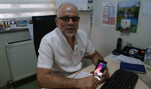 Kastamonu'da prostat büyümesi için endoskopik rezum ameliyatı