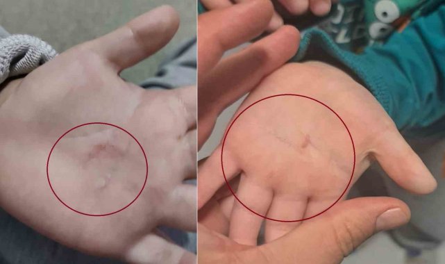 Bandırma Belediyesi'nin kreşinde 4 yaşındaki çocuğa şiddet iddiası