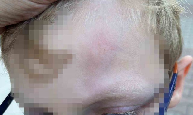 Beylikdüzü'nde okulda öğrenciye demir çubukla darp iddiası