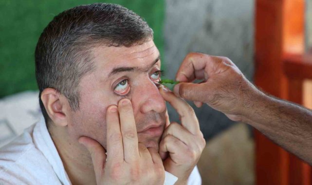 Randevu almayanları geri gönderiyor: Elazığ'da kırlangıç otu ile göz hastalıklarına umut