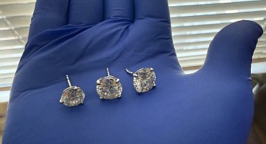 ABD'de hırsızın çaldıktan sonra yuttuğu 769 bin dolarlık küpeler mağazaya iade edildi