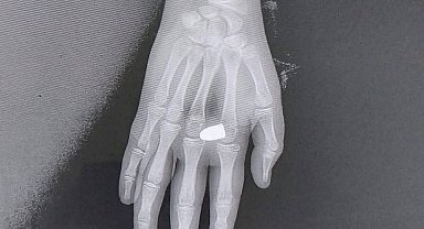 Eline yorgun mermi düşen çocuk yaralandı