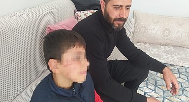 İlkokulda öğrencilerin kavgasına veli de karıştı; 1 yaralı