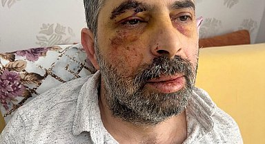 Köpeklerden kaçarken bisikletten düşüp, yaralandı