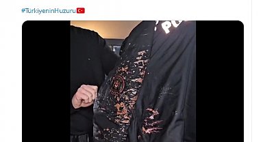 Yerlikaya: Saraçhane'de bu gece yapılan gösterilerde bir polis memurumuza asit atıldı