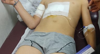 10 yaşındaki Ahmet, köpek saldırısında yaralandı