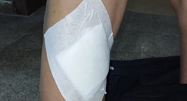 Başıboş köpekler 2 çocuğu ısırdı