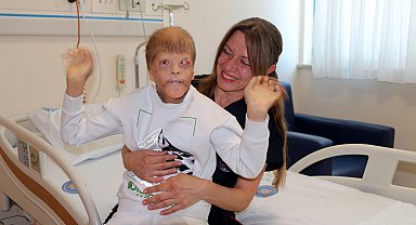 Gözleri kurtarılan Myhailo'ya, şimdi kulak kepçesi yapılacak