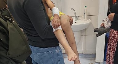 Malatya'da, sokakta oyun oynarken başıboş köpeklerin saldırısına uğrayan çocuk yaralandı