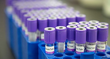 NHS: Kanseri tespit edebilen kan testini denemeye hazırız