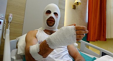 Nişanlısına hediye paketi hazırlarken patlayan sprey boya kutusu hastanelik etti