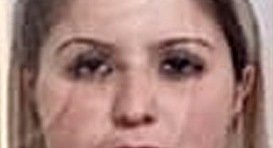 Ölü bulunan Gözde'nin vücudundaki morluklar, 3-4 günlükmüş