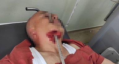 Şantiyede ayağı kayıp düşen işçinin yüzüne inşaat demiri saplandı