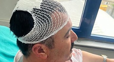 YRP'li İl Başkan Yardımcısı, Belediye Başkan Yardımcısı'nı şekerlikle başına vurarak yaraladı