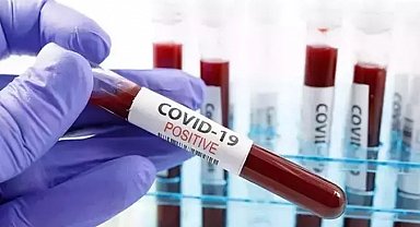 ABD'de her hafta 300'den fazla kişi Covid-19 nedeniyle hayatını kaybediyor