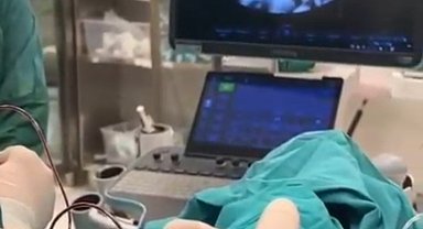 Anne karnındaki 8 aylık bebeğe kan nakli yapıldı